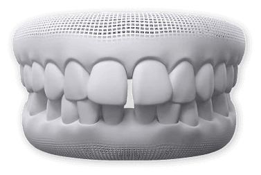 Gaps Between Teeth